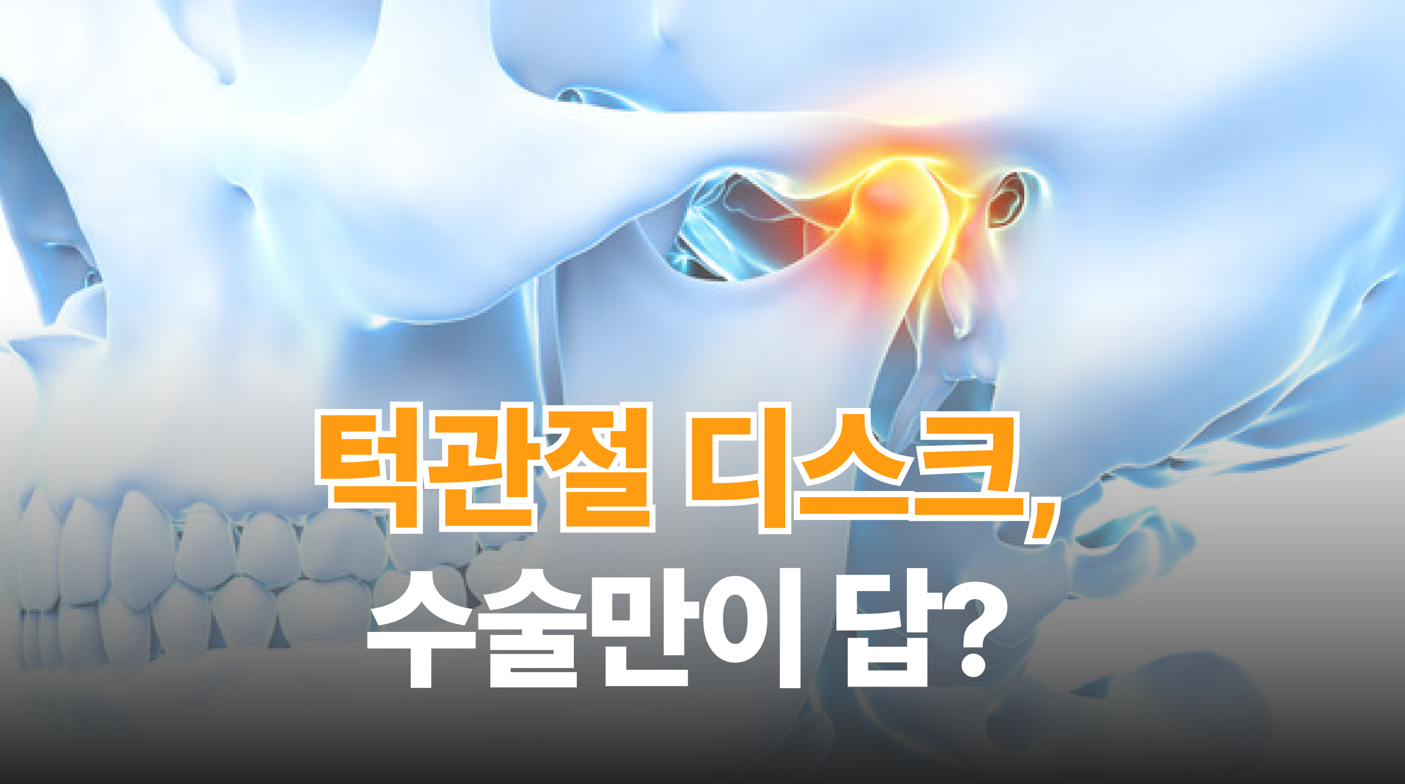 반복되는 딱딱소리, 턱관절 디스크 있으면 수술해야 하나요?
